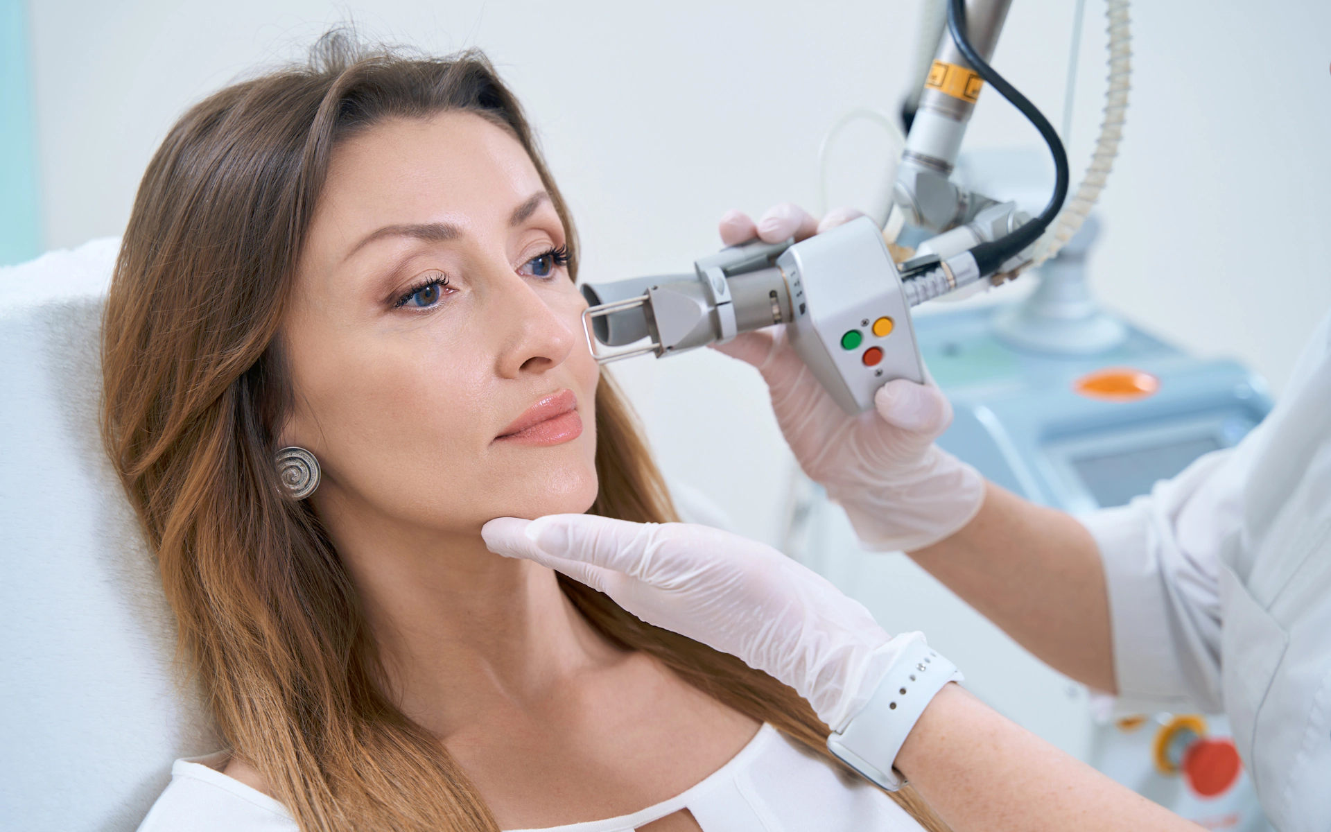 Acne Scar Removal